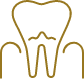 Animated tooth with receding gum tissue before periodontal therapy