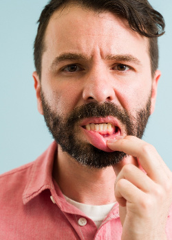 A man with bleeding gums